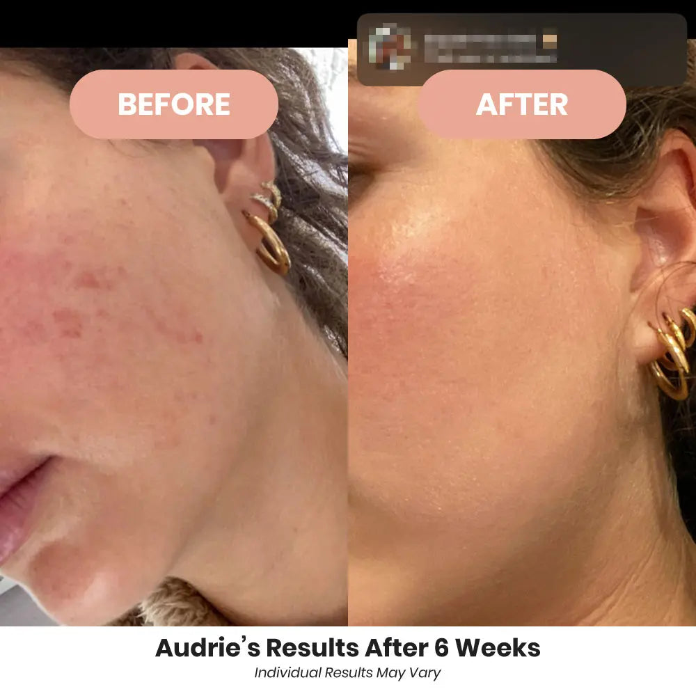 Gut Health Maintenance System